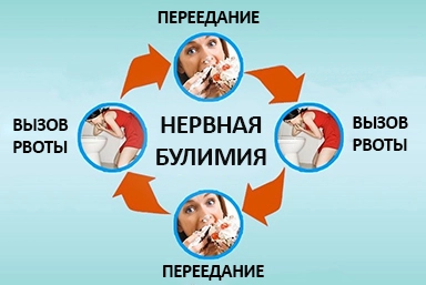Лечение булимии в Сергиевом Посаде